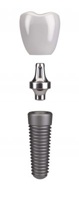 full_1_shutterstock_373305709-min